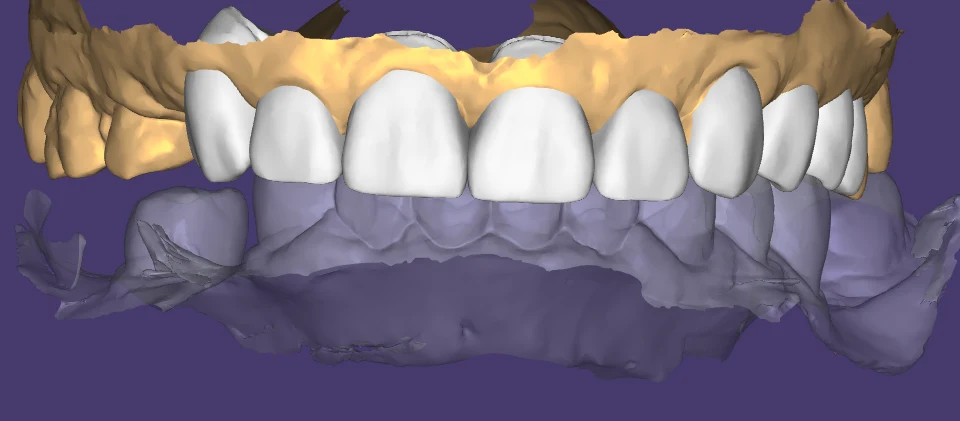 Conception 3D d'une restauration antérieure dans la visionneuse en ligne