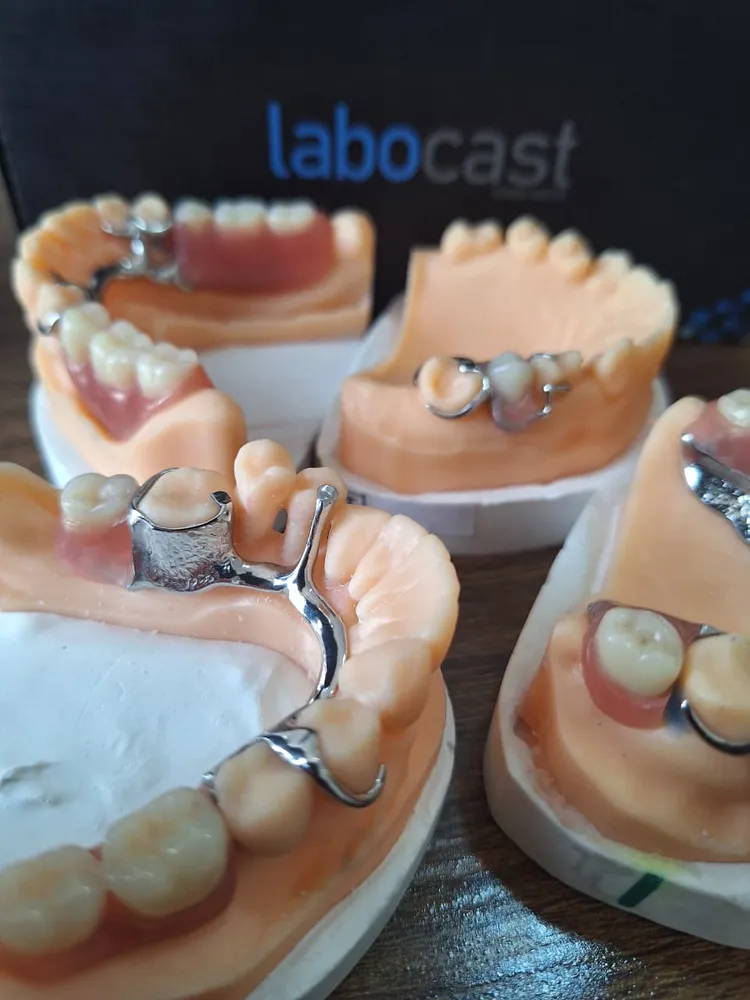 Plusieurs prothèses partielles sur modèles