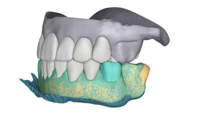 Mock-up numérique 3D d'un sourire