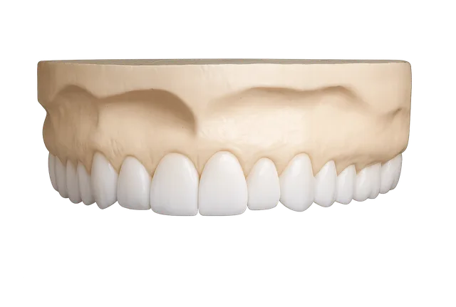 Wax-up diagnostique sur modèle
